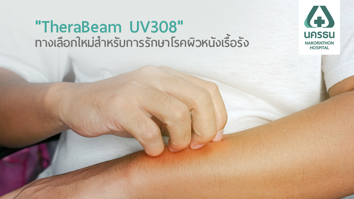 รักษาโรคผิวหนังด้วยนวัตกรรมใหม่ "TheraBeam UV308"